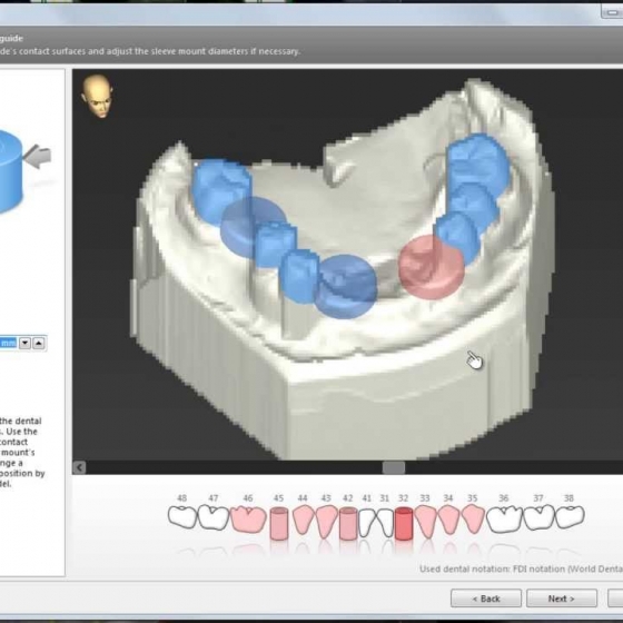 CoDiagnostiX 9 SOFTWARE