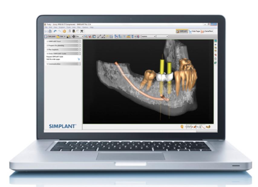 SIMPLANT LICENSE RENEWAL 2