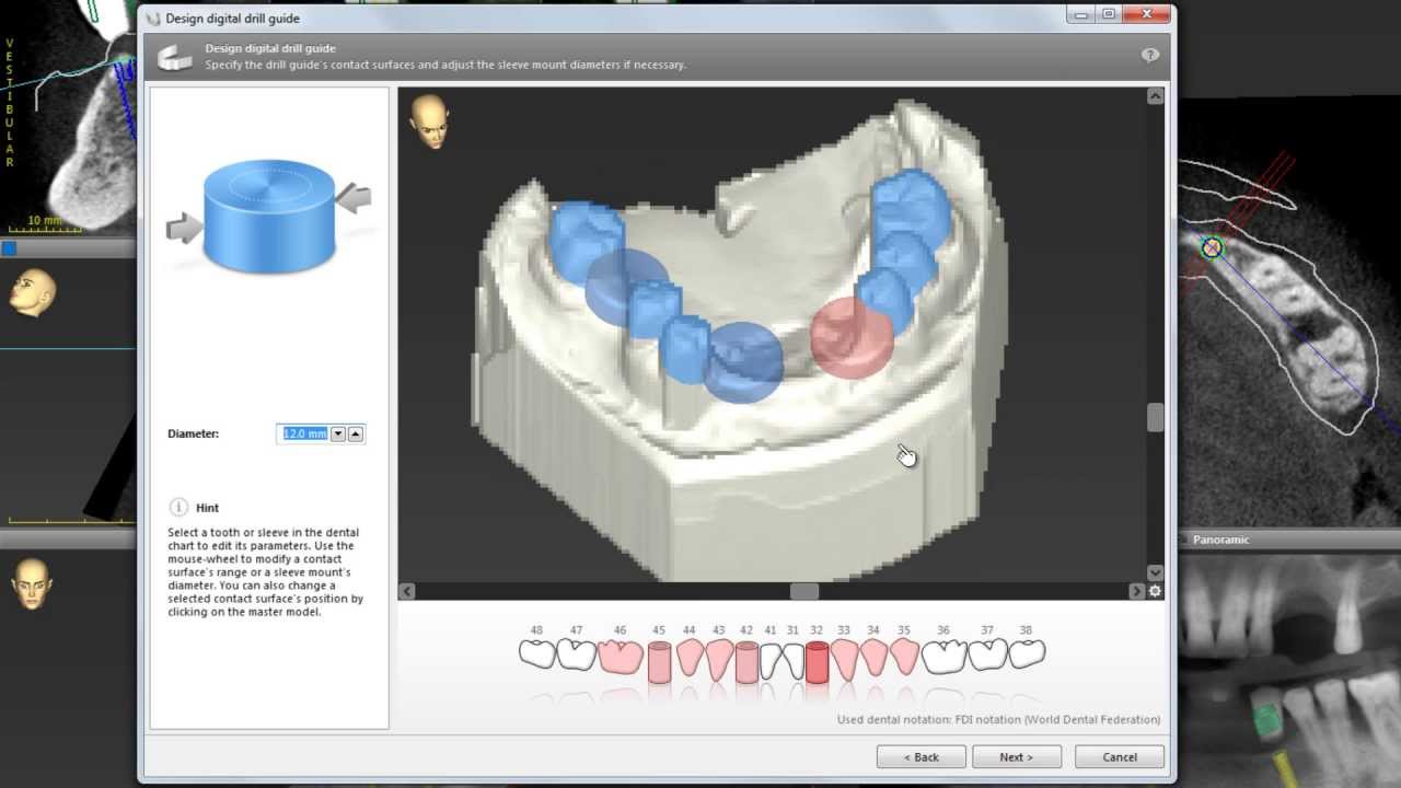 CoDiagnostiX 9 SOFTWARE