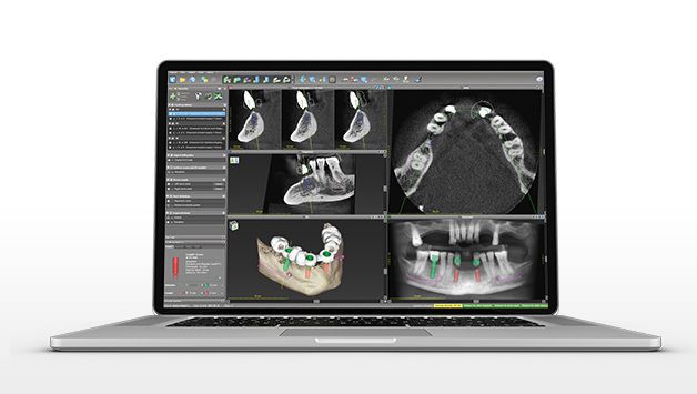 CoDiagnostix Demo/Evaluation V.9 license 3mo.