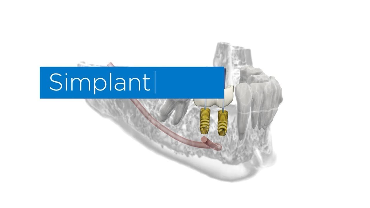 SURGIGUIDE UNIVERSAL FOR  1-14  IMPLANT